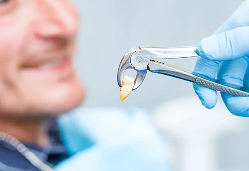 Close up regular extraction