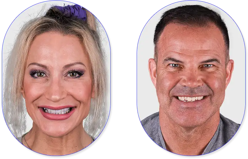 Female and male patients before getting dental veneers