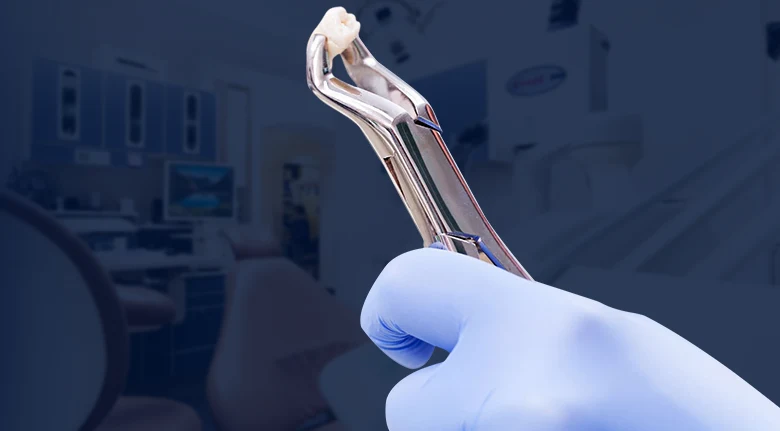 Dentist's hand holding clamp with extracted tooth