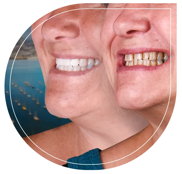 Patient at Dental Expressions receiving professional teeth cleaning