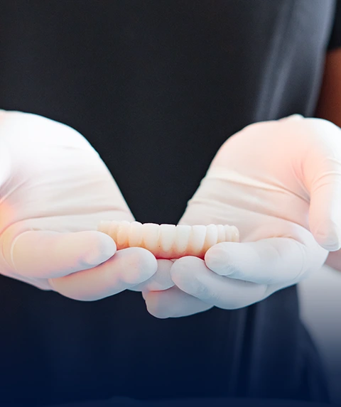 All-on-4 Fixed Hybrid Prosthesis