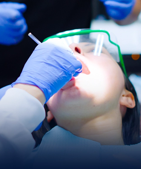 Teeth Cleaning at Dental Expressions