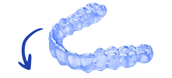 Dental bonding before and after