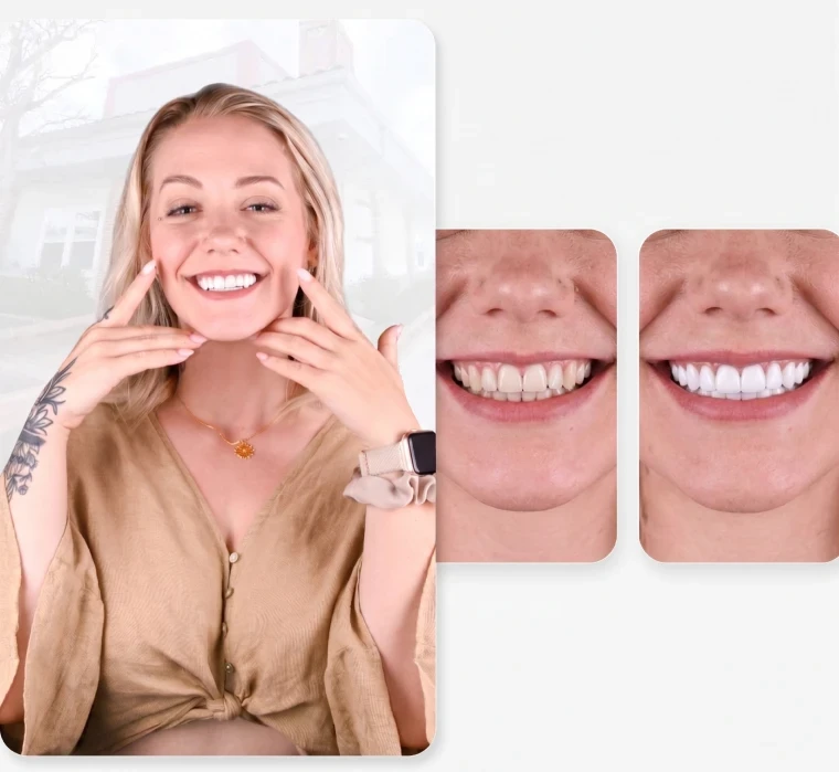 Dental Expression general prices in San Diego
